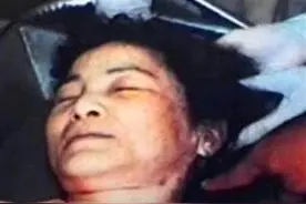 邓丽君在医院去世，记者近距离拍下遗体照片，令人深感惋惜！图片