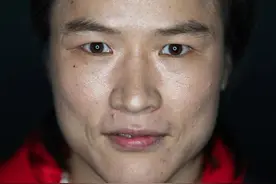 张伟丽晒UFC赛前赛后对比照，眼眶处出现淤青，发文：一切安好，加油，成为更好的自己图片