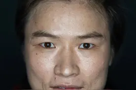 张伟丽晒UFC赛前赛后对比照，眼眶处出现淤青，发文：一切安好，加油，成为更好的自己图片