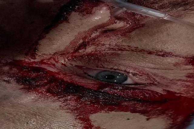 2025年战争中的乌克兰：照片中的一年