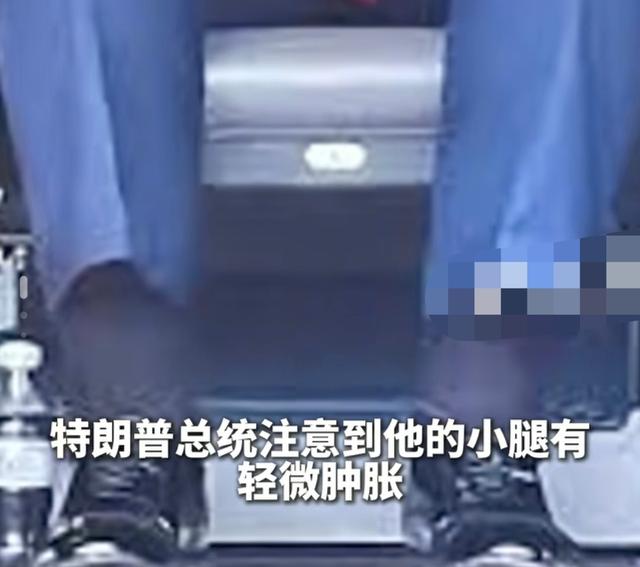 特朗普的身体到底出了什么问题