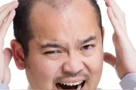 为什么你的头发越洗越少图片