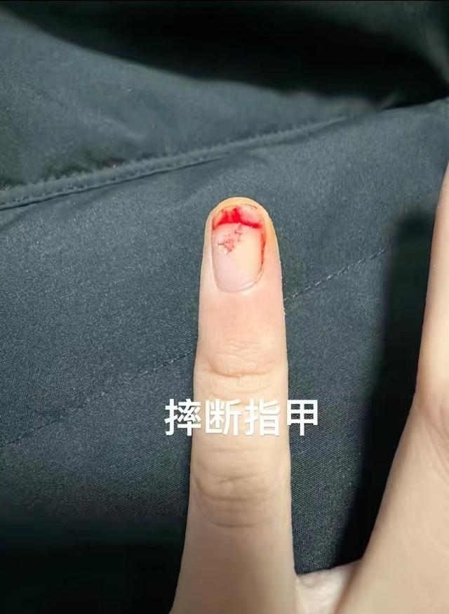 短剧女演员被男主一脚踹飞，指甲当场断裂，贾玲的话又一次应验了