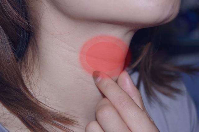 体内有癌	，喉咙先知？喉咙若出现5种现象，或许是癌细胞已到来