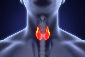 甲状腺眼病四大眼征，看看你有没有这些特征图片