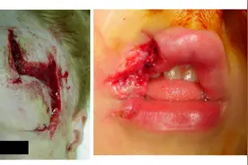 最高法明确！禁养的烈性犬伤人，犬主承担全责图片