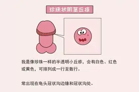 阴茎龟头上有小颗粒，别慌，可能是珍珠疹在“作祟”！图片