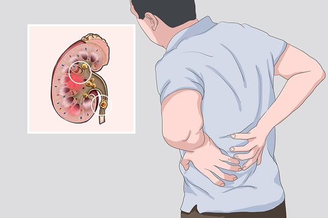 4 人失联 2 人遇难！高原旅行不只是冷，这几类疾病患者慎行