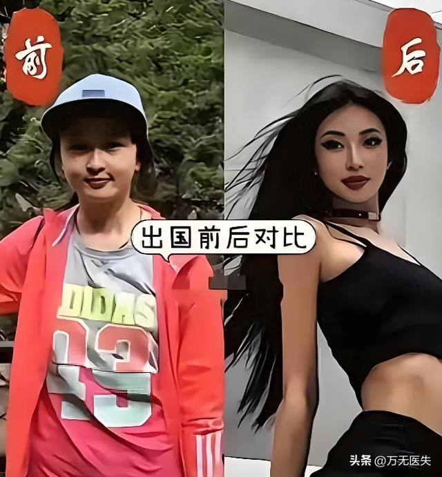 留学一年嘴都变大了，女学生面相变化图走红	，牢A果然权威