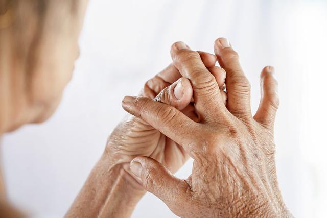 体内有癌，手指先知？提醒：手部若有3个异常，或是癌症预警