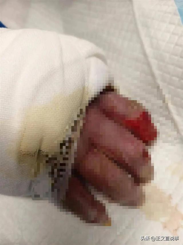 人财两空！贵州40岁男子钱开红去世，花费140万	，病情本有所恢复