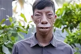 印尼“马脸一家”：因父亲基因太强大，5个兄弟姐妹4个“马脸”图片