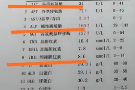肝病不痛不痒？6个关键指标异常，再拖就晚了图片