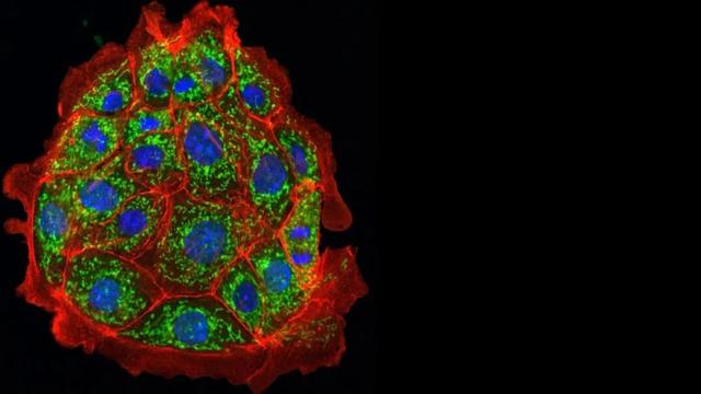 迄今世界第一大蛛网：106平米，11万只蜘蛛的家