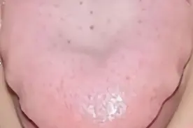 胃胀反胃，恶心呕吐？这四种原因引起的，中医教你正确调理！图片