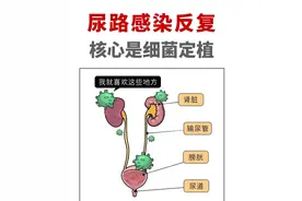 尿路感染首选的五大王牌治疗药物，你知道几个图片