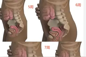 怀孕2个月，胎儿的样子。图片
