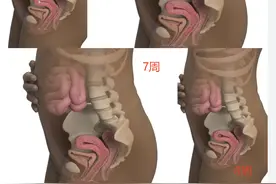 怀孕2个月，胎儿的样子。图片