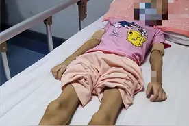 15岁少女为爱减肥只剩48斤，连续50天只喝水，妈妈含泪拔她氧气管图片