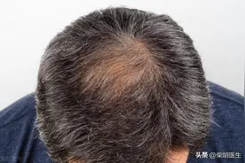 【生发饮】千古乌发第一方，仅四味！通补兼施！专克须发早白！图片