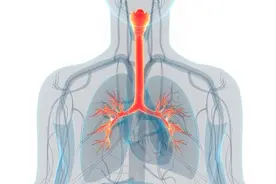 咳嗽是过敏还是肺癌？有痰、无痰透露不同信号，教你分辨6种病因图片