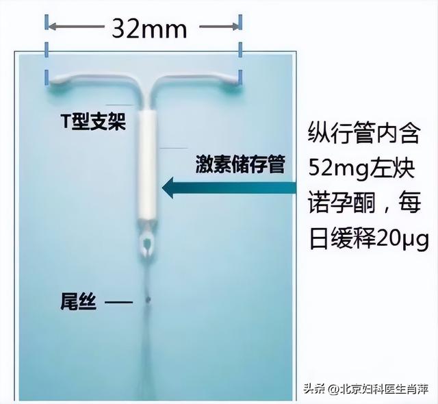 戴曼月乐环后，这 3 个信号可能是 “环下移” 了!别忽视