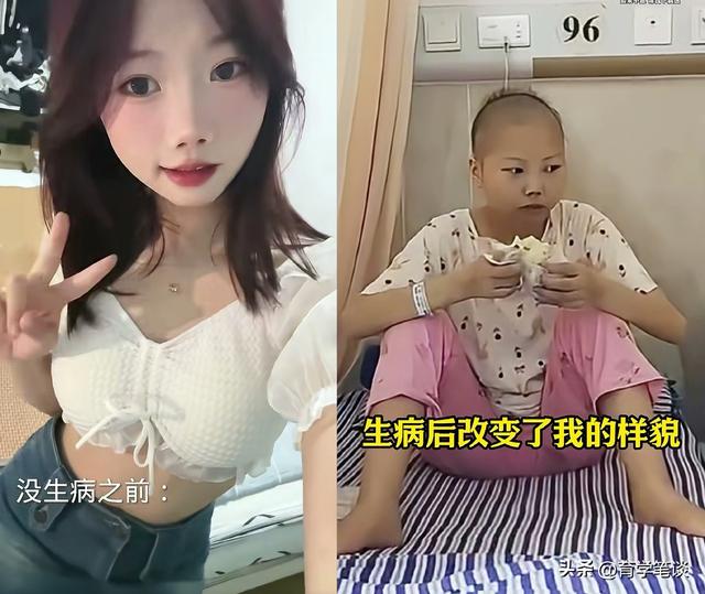 江西女幼师刘慧去世，仅21岁，娃娃脸很漂亮，身上莫名淤青后确诊