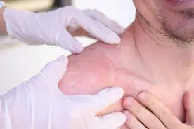 冠心病患者注意：身体出现这几处瘙痒，要立即去医院！图片