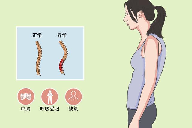 造成胃酸反流的原因？胃胀胃酸胃反流怎么办？