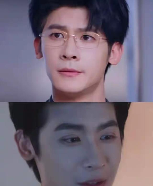 脸没恢复就别出来拍短剧，顶着膨化脸	、大刀双眼皮	，太让人出戏了