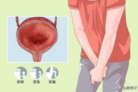 尿路感染炎症又反复了，还是血尿！什么时候才是个头！要疯了！图片