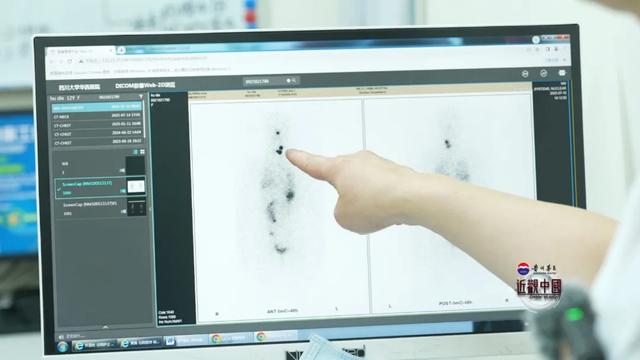 老外看核技术应用“中国安全打开方式” 从食物灭菌到治癌利器...