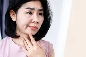 得了周围性面神经麻痹该怎么办？科学服用5类药物，修复受损神经图片