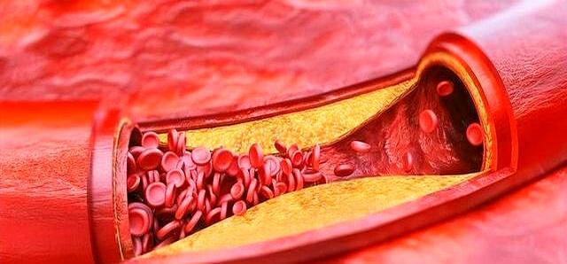 低温天气究竟如何科学健身钟南山提醒天冷运动需注意五点