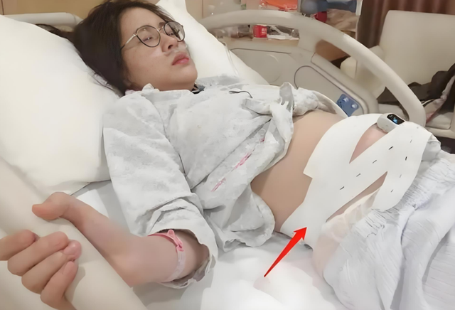 输了里子丢了面子，管不住下半身的张碧晨，被汪苏泷撕掉最后体面
