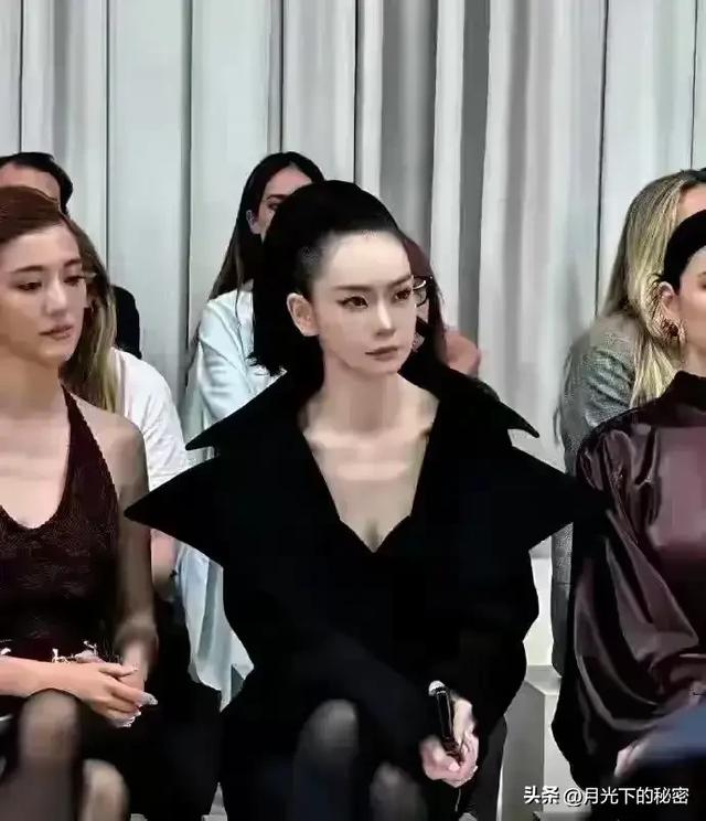 戚薇脸上做拉皮不疼吗? 但一却为了美 这样拉的发际线后移好难看