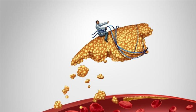 长期喝茶的人	，最后都怎样了？研究发现：每天2-3杯茶或可延寿