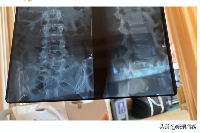 面试被打后续：警方出手，更多受害者站出来，老板身份越扒越可怕