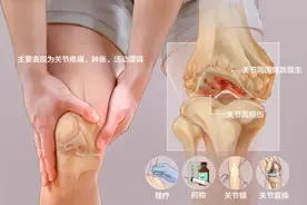 减轻疼痛，再生软骨！干细胞治疗关节炎已成为趋势图片