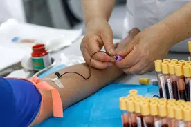 血常规如何鉴别肝硬化、肝癌是否进展？主要看这4点！图片