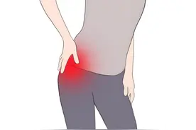 经常胯骨疼，可能源于这 4 种原因图片