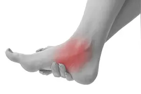 起床踩地脚就痛，简单4招踢走足底筋膜炎图片