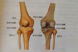 走路膝盖突然“软”一下？警惕！或许是这些疾病的信号→图片