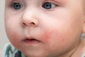 母乳过敏 vs 乳糖不耐受：别再傻傻分不清！教你科学区分与应对图片