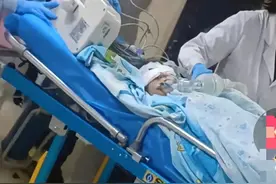 最新消息：崇州黑狗主人已找到，医生说女童后期治疗费用相当高！图片