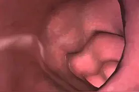 在广州做胃肠镜检查的亲身经历，本来以为挺贵，有医保报销真香图片