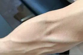 手臂“青筋暴起”的人，和几乎看不到青筋的人相比，哪种更健康？图片