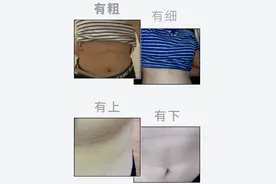 为什么女生的胸部下面，都会有一根“细线”？图片