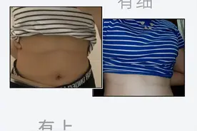为什么女生的胸部下面，都会有一根“细线”？图片