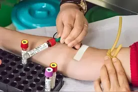 尿毒症病人如果不透析的话能活多少天呢？图片